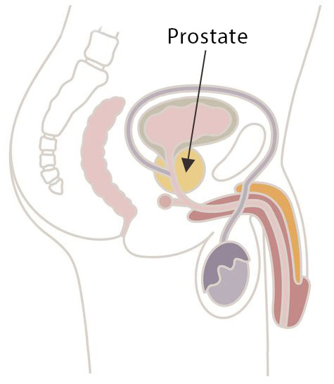 Prostate